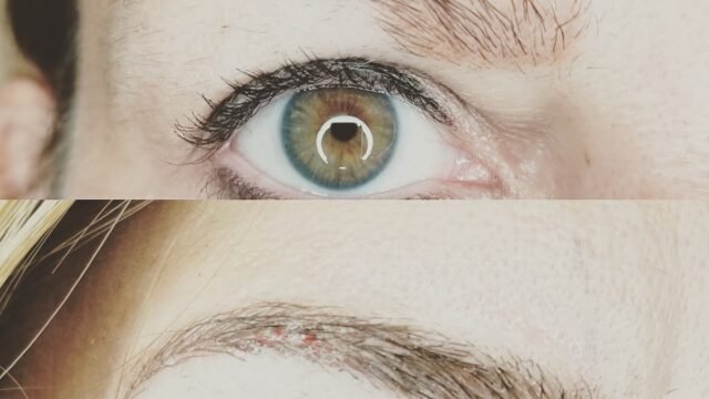 Brow Help