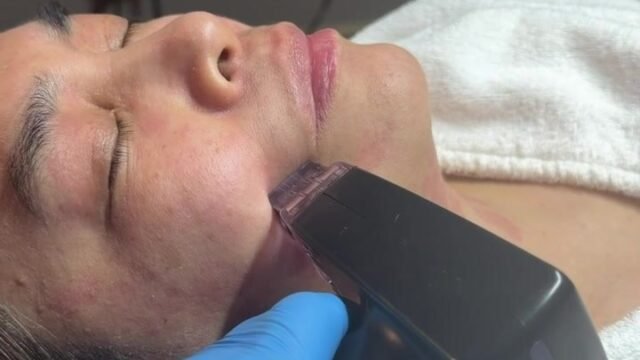 Natural Rejuvenation MedSpa